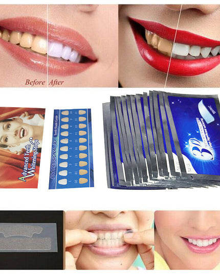 Dantų balinimo juostelės 3D Whitening 28vnt/14 porų