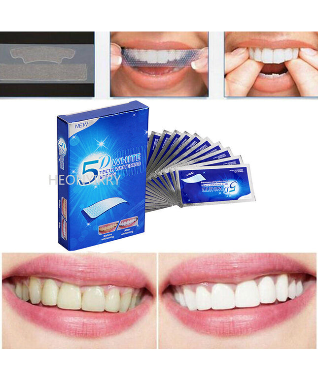 Dantų balinimo juostelės 5D White, 28 vnt/14 porų